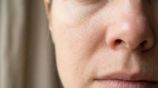 Prečo je pleť suchá a citlivá, aj keď používate krém?